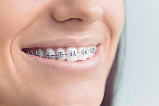 Why Choose Us for Your Dental Needs in Fort Worth, TX